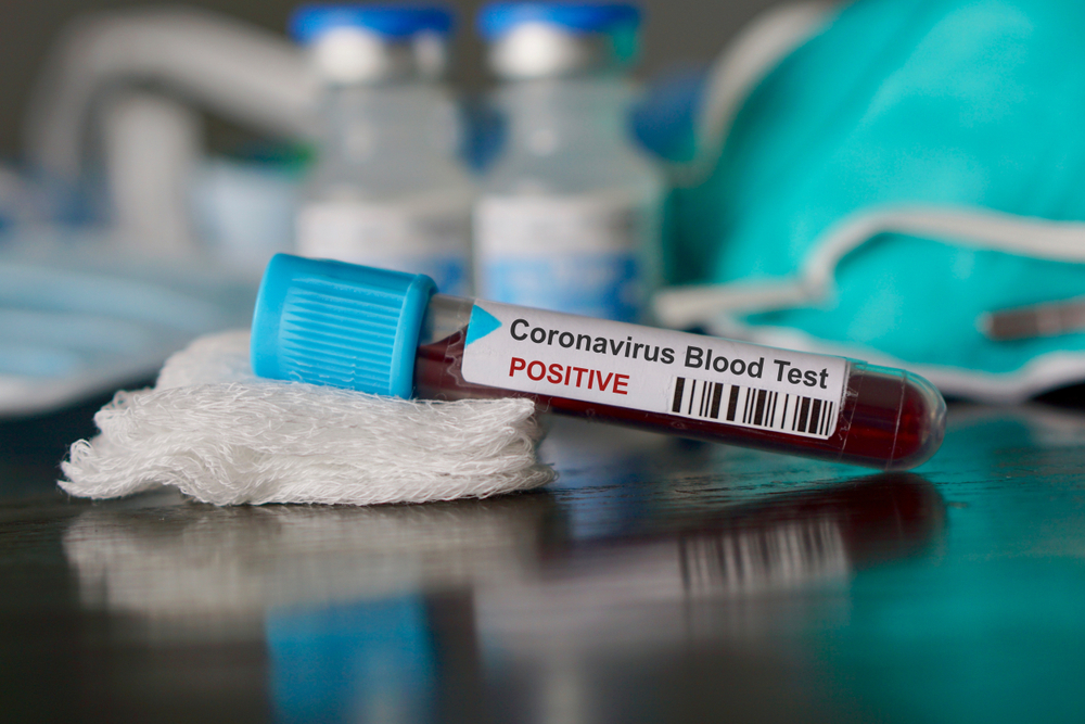 Coronavirus in Boulder County: Officials urge public not to panic — just stay away from other people